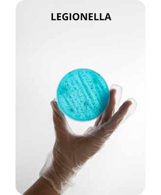 Legionella